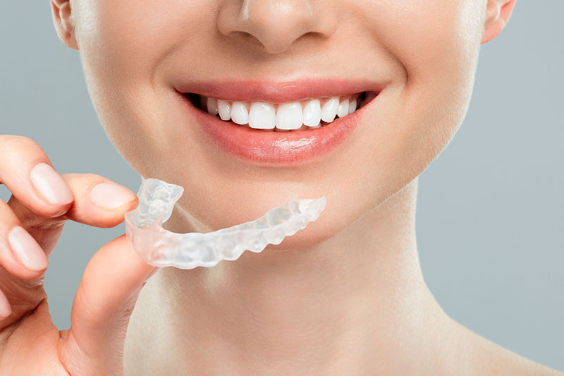 Clear Aligners - Dr. Ben Franz, Ketchum Dentist